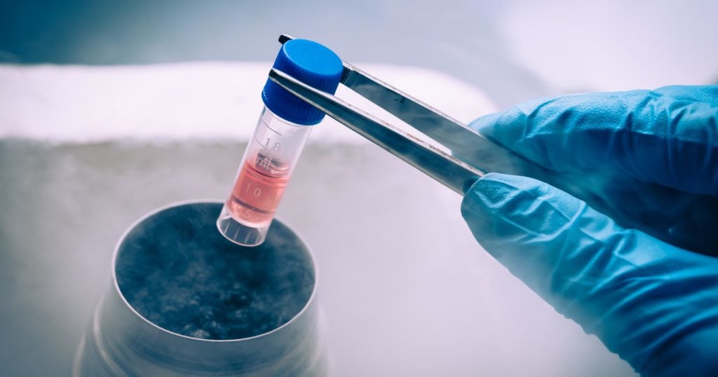 Benefits of Stem Cell Therapy